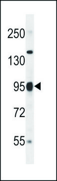 ANTI-PARP9 (C-TERM) antibody produced in rabbit IgG fraction of antiserum, buffered aqueous solution