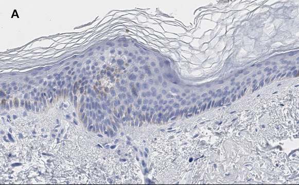 Anti-phos-AMPK&#945; (Thr172) Antibody, clone 5J23 , ZooMAb&#174; Rabbit Monoclonal recombinant, expressed in HEK 293 cells