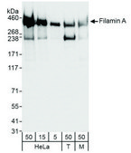 Rabbit anti-Filamin A Antibody, Affinity Purified Powered by Bethyl Laboratories, Inc.