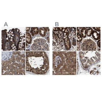 Anti-GCC1 antibody produced in rabbit Prestige Antibodies&#174; Powered by Atlas Antibodies, affinity isolated antibody, buffered aqueous glycerol solution