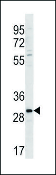 ANTI-ZDHC3 (N-TERM) antibody produced in rabbit IgG fraction of antiserum, buffered aqueous solution