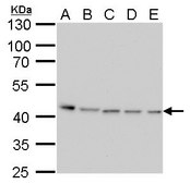 Monoclonal Anti-PRMT1 antibody produced in mouse clone GT779, affinity isolated antibody