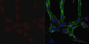 Anti-Nuclear Pore Complex Proteins Antibody, clone 414 clone 414, from mouse