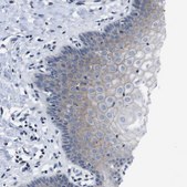 Anti-SEMA4B antibody produced in rabbit Prestige Antibodies® Powered by Atlas Antibodies, affinity isolated antibody, buffered aqueous glycerol solution
