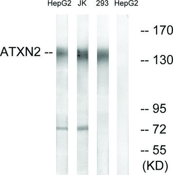 Anti-ATXN2 antibody produced in rabbit affinity isolated antibody