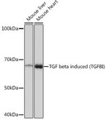 Anti-TGF beta induced (TGFBI) Antibody, clone 7Q5O9, Rabbit Monoclonal