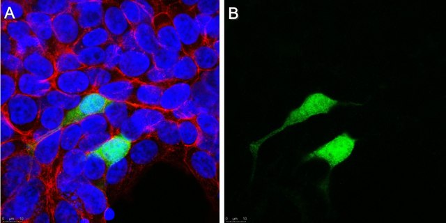 Anti-Chloramphenicol Acetyltransferase Antibody, clone CAT-1