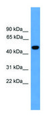 Anti-PSEN1 antibody produced in rabbit affinity isolated antibody