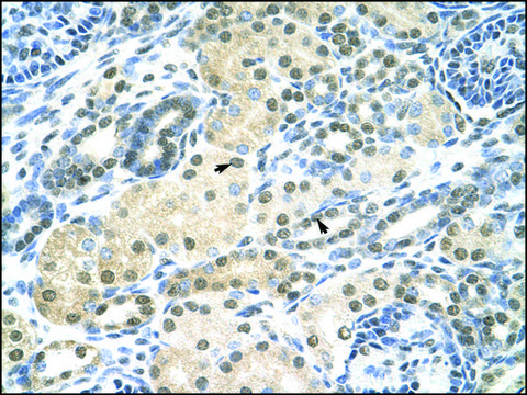 Anti-SMARCE1 antibody produced in rabbit affinity isolated antibody