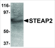 Anti-STEAP2 antibody produced in rabbit affinity isolated antibody, buffered aqueous solution
