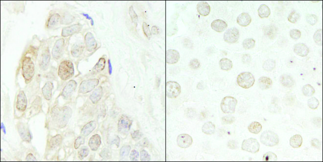 Rabbit anti-CDK2 Antibody, Affinity Purified Powered by Bethyl Laboratories, Inc.