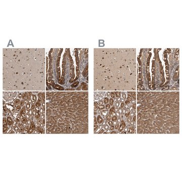 Anti-TRMT61B antibody produced in rabbit Prestige Antibodies&#174; Powered by Atlas Antibodies, affinity isolated antibody, buffered aqueous glycerol solution, Ab2