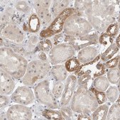 Anti-MTFR1L antibody produced in rabbit Prestige Antibodies® Powered by Atlas Antibodies, affinity isolated antibody, buffered aqueous glycerol solution, ab1