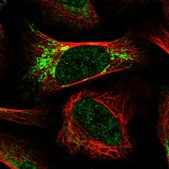 Anti-RTKN antibody produced in rabbit Prestige Antibodies® Powered by Atlas Antibodies, affinity isolated antibody, buffered aqueous glycerol solution
