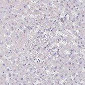 Anti-ITLN1 antibody produced in rabbit Prestige Antibodies® Powered by Atlas Antibodies, affinity isolated antibody, buffered aqueous glycerol solution