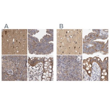 Anti-TSPOAP1 antibody produced in rabbit Prestige Antibodies&#174; Powered by Atlas Antibodies, affinity isolated antibody, buffered aqueous glycerol solution, Ab2