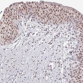 Anti-TMED5 antibody produced in rabbit Prestige Antibodies® Powered by Atlas Antibodies, affinity isolated antibody, buffered aqueous glycerol solution