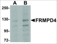 Anti-FRMPD4 antibody produced in rabbit affinity isolated antibody, buffered aqueous solution