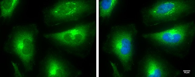 Monoclonal Anti-mTOR antibody produced in mouse clone GT6611, affinity isolated antibody