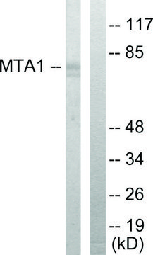 Anti-MTA1 antibody produced in rabbit affinity isolated antibody