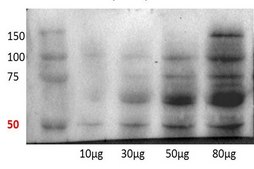 Anti-KLF4 antibody produced in rabbit affinity isolated antibody