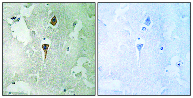 抗-NMDAR1 兔抗 affinity isolated antibody