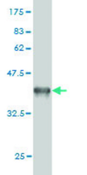 ANTI-GUCY2D antibody produced in mouse clone 6D9, purified immunoglobulin, buffered aqueous solution