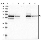 Anti-COASY antibody produced in rabbit Prestige Antibodies® Powered by Atlas Antibodies, affinity isolated antibody, buffered aqueous glycerol solution, Ab1
