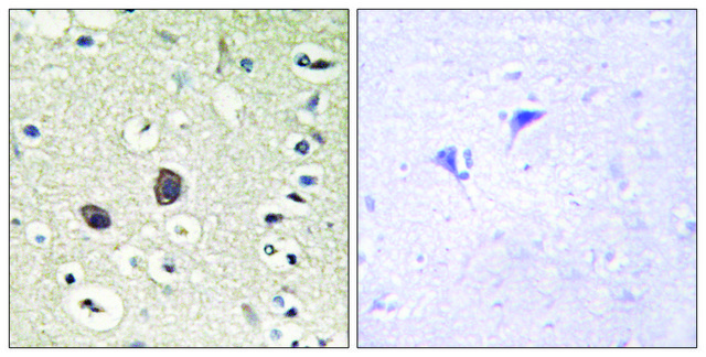 Anti-TIE2, C-Terminal antibody produced in rabbit affinity isolated antibody