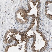 Anti-NUCB1 antibody produced in rabbit Prestige Antibodies® Powered by Atlas Antibodies, affinity isolated antibody, buffered aqueous glycerol solution