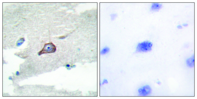 Anti-HCK antibody produced in rabbit affinity isolated antibody