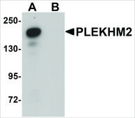 Anti-PLEKHM2 antibody produced in rabbit affinity isolated antibody, buffered aqueous solution
