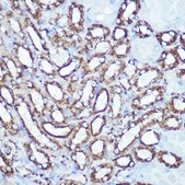 Anti- HK1 antibody produced in rabbit