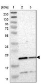 Anti-TMED2 antibody produced in rabbit Prestige Antibodies® Powered by Atlas Antibodies, affinity isolated antibody, buffered aqueous glycerol solution