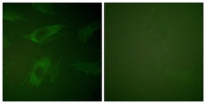 Anti-Rabphilin 3A antibody produced in rabbit affinity isolated antibody