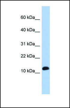 Anti-RPL30 antibody produced in rabbit affinity isolated antibody