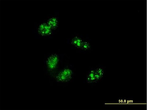 Monoclonal Anti-TCOF1 antibody produced in mouse clone 8H3, purified immunoglobulin, buffered aqueous solution