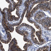 Anti-CCDC146 antibody produced in rabbit Prestige Antibodies® Powered by Atlas Antibodies, affinity isolated antibody, buffered aqueous glycerol solution, Ab1