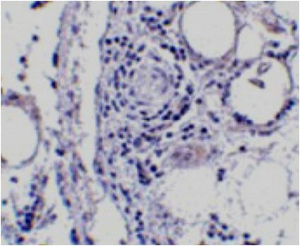 Anti-FABP7 Antibody from rabbit, purified by affinity chromatography