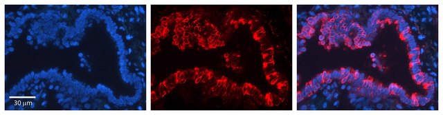 Anti-KRT7 antibody produced in rabbit affinity isolated antibody