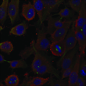 Anti-MAP1LC3A antibody produced in rabbit affinity isolated antibody