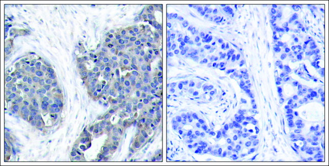 Anti-STMN1 (Ab-38) antibody produced in rabbit affinity isolated antibody