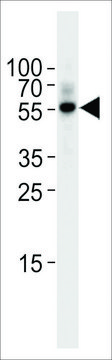 ANTI-TGF BETA 2(C-TERMINAL) antibody produced in rabbit IgG fraction of antiserum, buffered aqueous solution