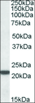 Anti-PSMB8 (C-terminal) antibody produced in goat affinity isolated antibody, buffered aqueous solution