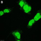 Anti-SOX-11 Antibody, clone 1F16 ZooMAb® Rabbit Monoclonal recombinant, expressed in HEK 293 cells