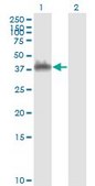 Monoclonal Anti-ANXA2 antibody produced in mouse clone 3E8-B6, purified immunoglobulin, buffered aqueous solution