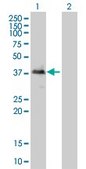Monoclonal Anti-TOB2 antibody produced in mouse clone 2F2-1A7, purified immunoglobulin, buffered aqueous solution