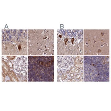 Anti-SPRYD3 antibody produced in rabbit Prestige Antibodies&#174; Powered by Atlas Antibodies, affinity isolated antibody, buffered aqueous glycerol solution