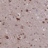 Anti-PYCR1 antibody produced in rabbit Prestige Antibodies® Powered by Atlas Antibodies, affinity isolated antibody, buffered aqueous glycerol solution