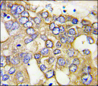 Anti-IGFBP3 (C-term) antibody produced in rabbit IgG fraction of antiserum, buffered aqueous solution